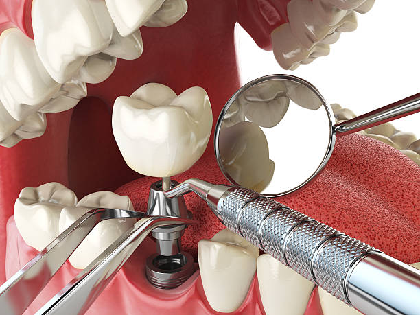 Best Cracked Tooth Emergency Dentist  in Richlandtown, PA